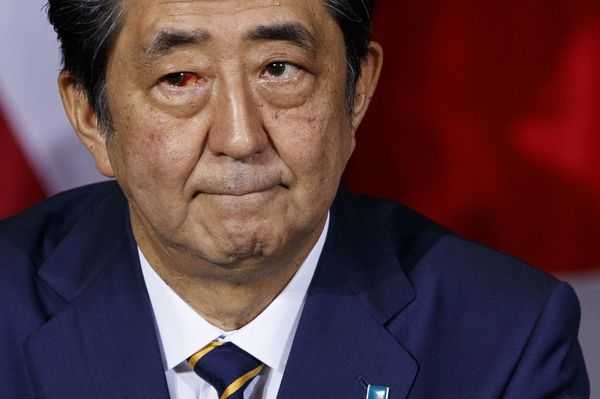 記事サムネイル